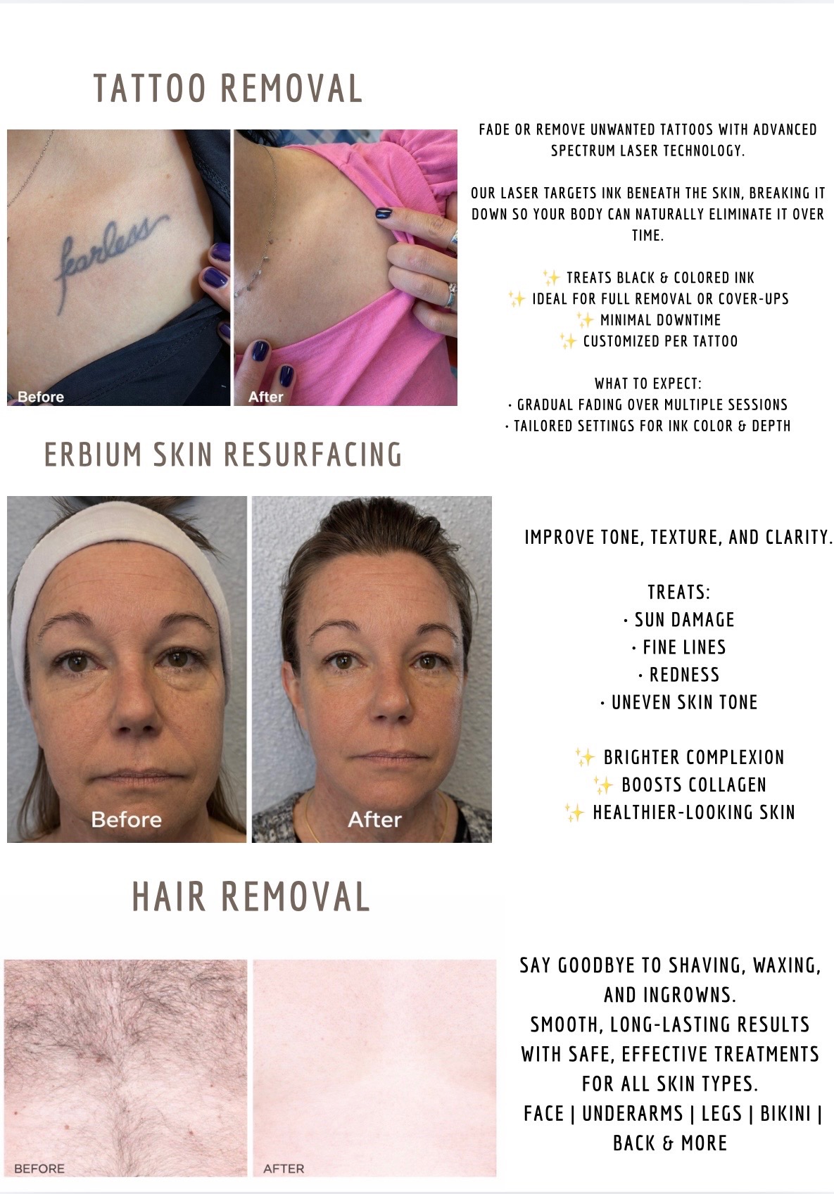 Laser Services Laser Services