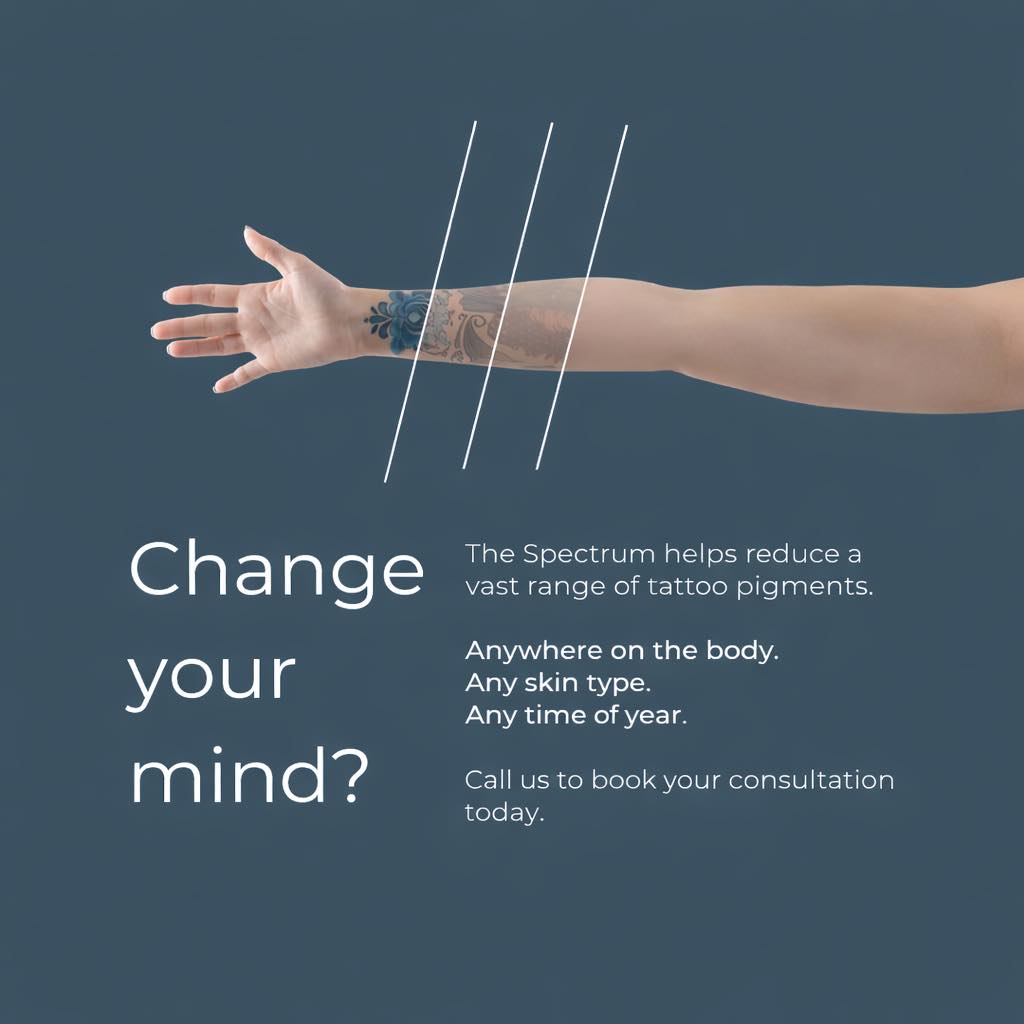 Laser Services Laser Services